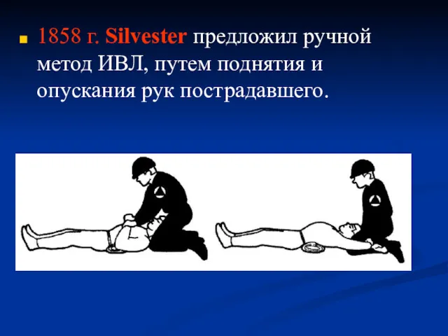 1858 г. Silvester предложил ручной метод ИВЛ, путем поднятия и опускания рук пострадавшего.