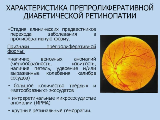 ХАРАКТЕРИСТИКА ПРЕПРОЛИФЕРАТИВНОЙ ДИАБЕТИЧЕСКОЙ РЕТИНОПАТИИ Стадия клинических предвестников перехода заболевания в