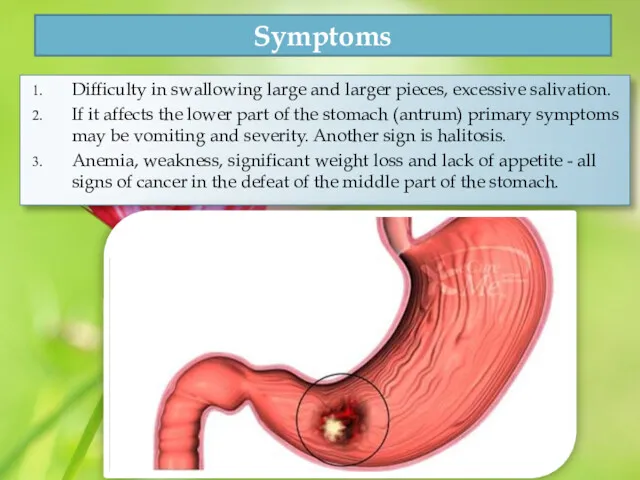 Symptoms Difficulty in swallowing large and larger pieces, excessive salivation.