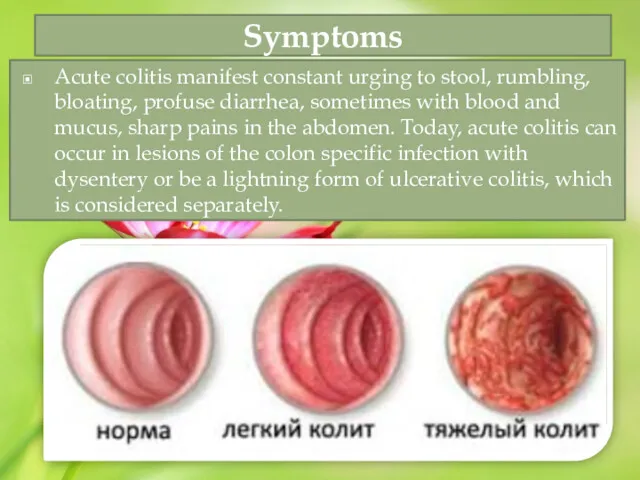 Symptoms Acute colitis manifest constant urging to stool, rumbling, bloating, profuse diarrhea, sometimes