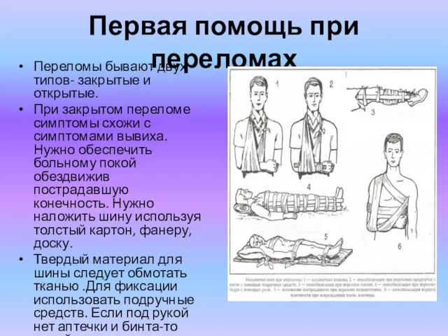 Первая помощь при переломах Переломы бывают двух типов- закрытые и