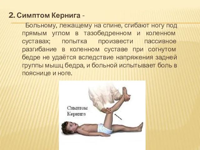 2. Симптом Кернига - Больному, лежащему на спине, сгибают ногу под прямым углом
