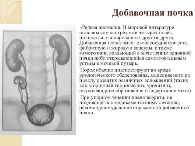 Добавочная почка -Редкая аномалия. В мировой литературе описаны случаи трёх