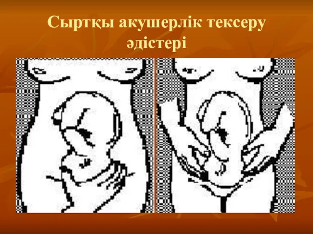 Сыртқы акушерлік тексеру әдістері