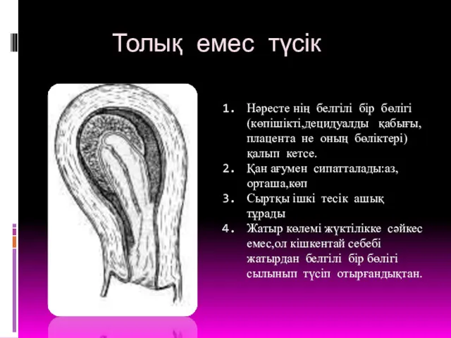 Толық емес түсік Нәресте нің белгілі бір бөлігі(көпішікті,децидуалды қабығы,плацента не