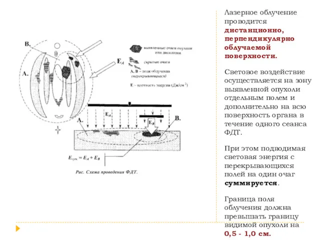 Лазерное облучение проводится дистанционно, перпендикулярно облучаемой поверхности. Световое воздействие осуществляется