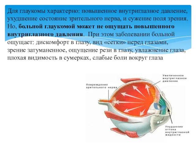 Для глаукомы характерно: повышенное внутриглазное давление, ухудшение состояние зрительного нерва, и сужение поля