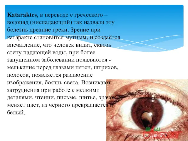 Kataraktes, в переводе с греческого – водопад (ниспадающий) так назвали эту болезнь древние
