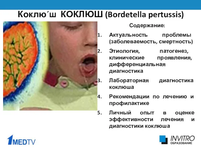 Коклю´ш КОКЛЮШ (Bordetella pertussis) Содержание: Актуальность проблемы (заболеваемость, смертность) Этиология,