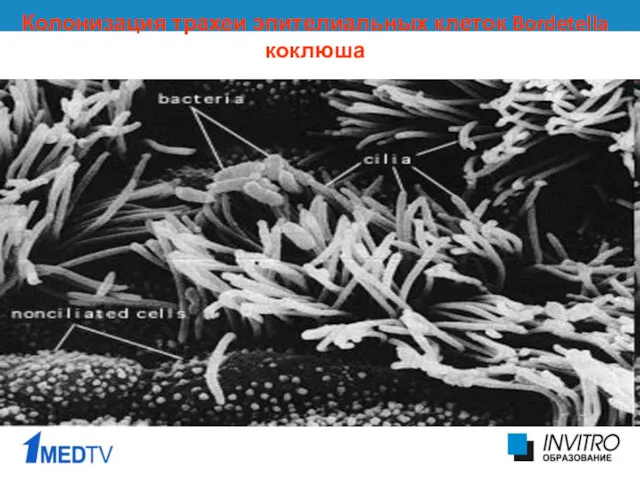 Колонизация трахеи эпителиальных клеток Bordetella коклюша