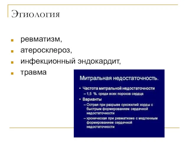 Этиология ревматизм, атеросклероз, инфекционный эндокардит, травма