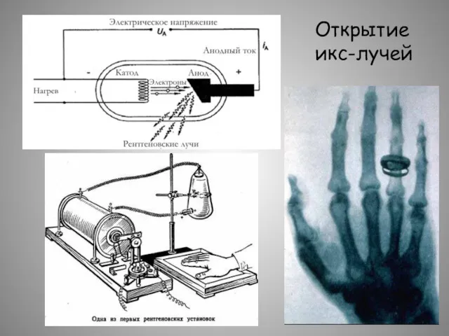 Открытие икс-лучей