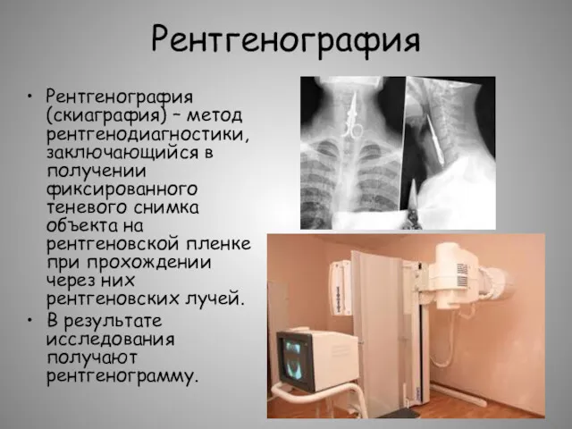 Рентгенография Рентгенография (скиаграфия) – метод рентгенодиагностики, заключающийся в получении фиксированного