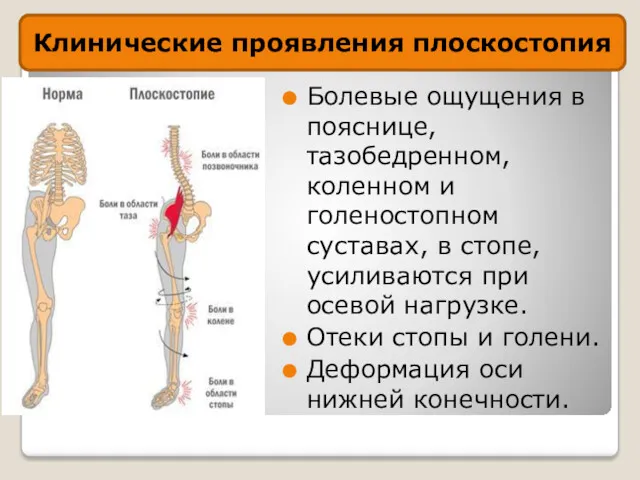 Болевые ощущения в пояснице, тазобедренном, коленном и голеностопном суставах, в