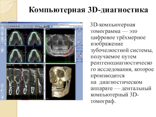 Компьютерная 3D-диагностика 3D-компьютерная томограмма — это цифровое трёхмерное изображение зубочелюстной