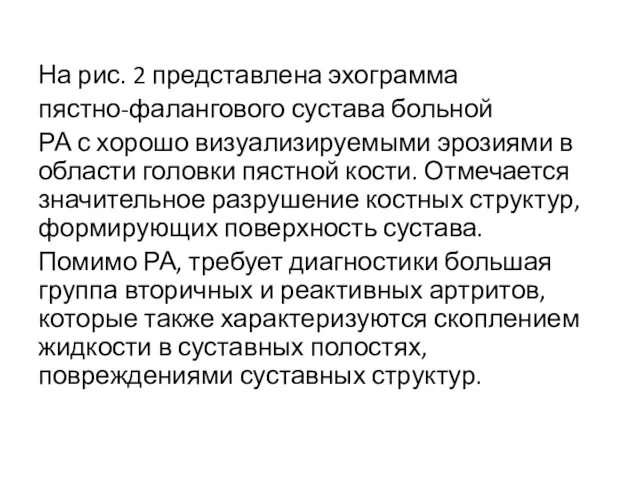 На рис. 2 представлена эхограмма пястно-фалангового сустава больной РА с