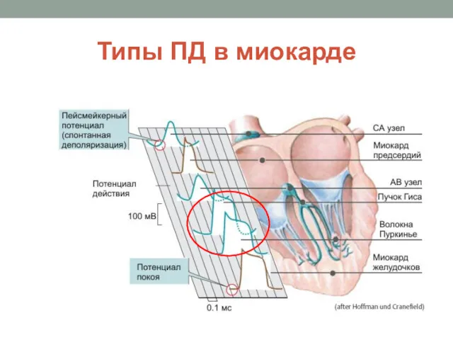 Типы ПД в миокарде