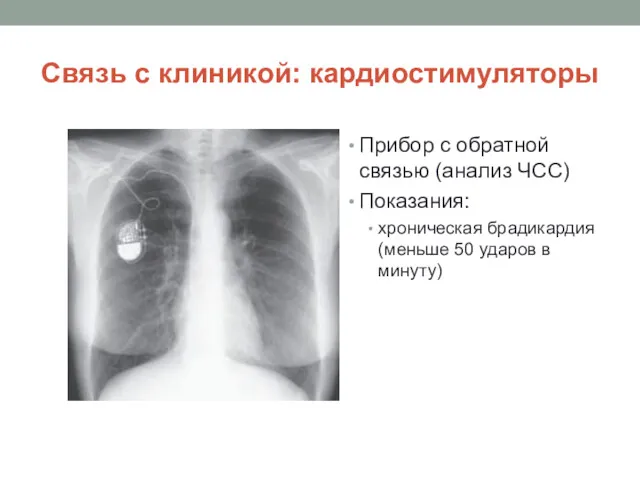 Связь с клиникой: кардиостимуляторы Прибор с обратной связью (анализ ЧСС)