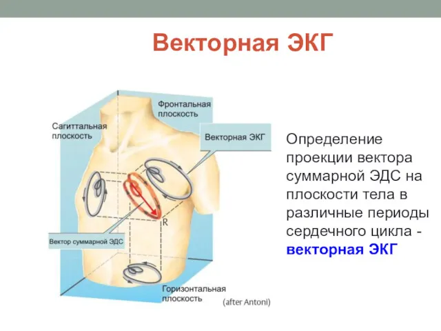 Векторная ЭКГ Определение проекции вектора суммарной ЭДС на плоскости тела