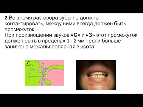 2.Во время разговора зубы не должны контактировать, между ними всегда