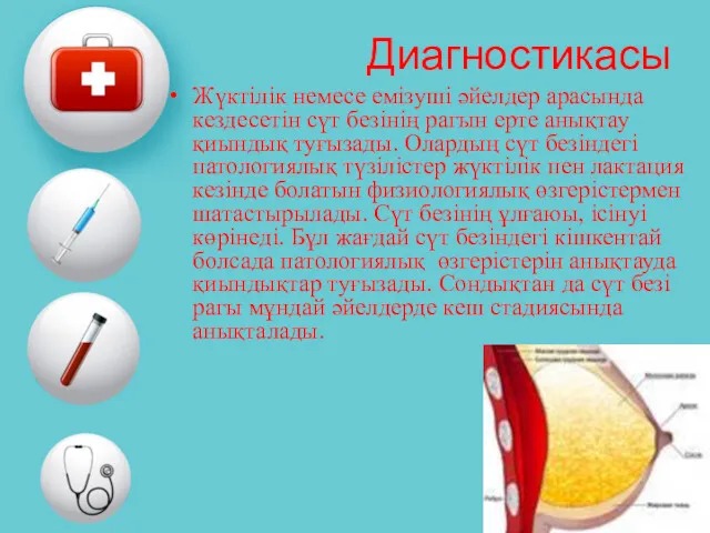 Диагностикасы Жүктілік немесе емізуші әйелдер арасында кездесетін сүт безінің рагын