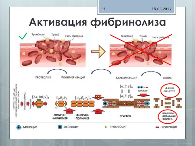 Активация фибринолиза 18.05.2017