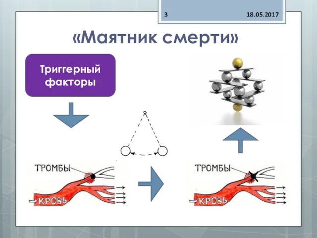 «Маятник смерти» 18.05.2017 Триггерный факторы