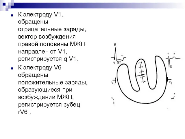 К электроду V1, обращены отрицательные заряды, вектор возбуждения правой половины