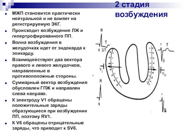 2 стадия возбуждения МЖП становится практически нейтральной и не влияет