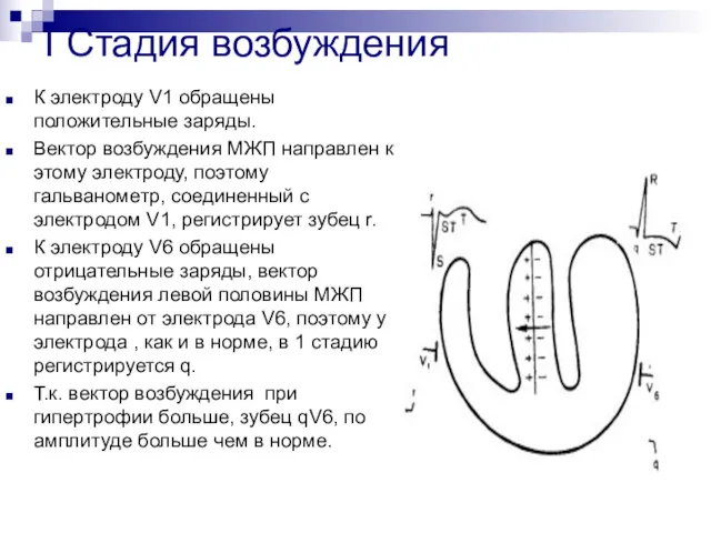 І Стадия возбуждения К электроду V1 обращены положительные заряды. Вектор