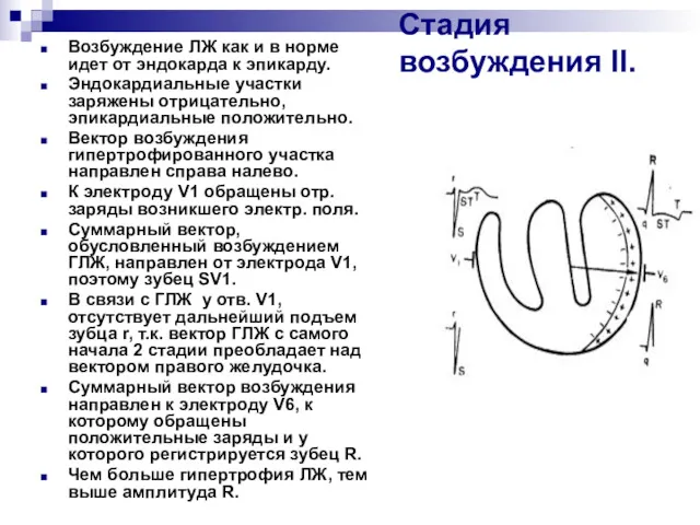 Стадия возбуждения ІІ. Возбуждение ЛЖ как и в норме идет