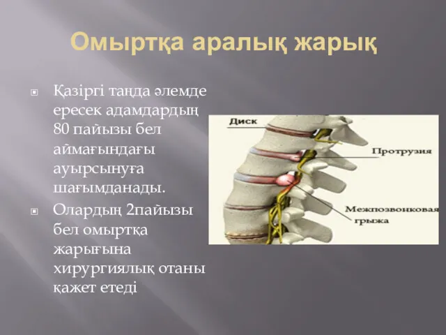 Омыртқа аралық жарық Қазіргі таңда әлемде ересек адамдардың 80 пайызы