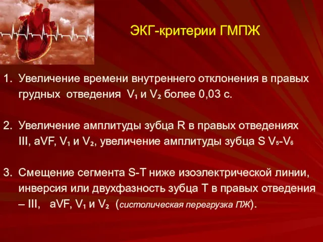 ЭКГ-критерии ГМПЖ 1. Увеличение времени внутреннего отклонения в правых грудных отведения V₁ и