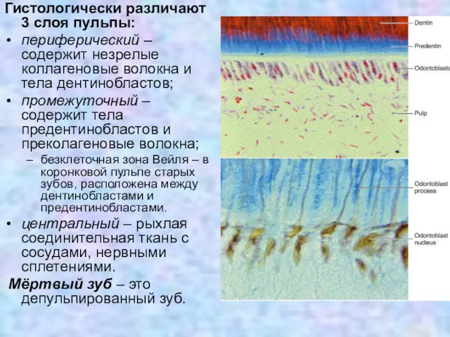 Гистологически различают 3 слоя пульпы: периферический – содержит незрелые коллагеновые