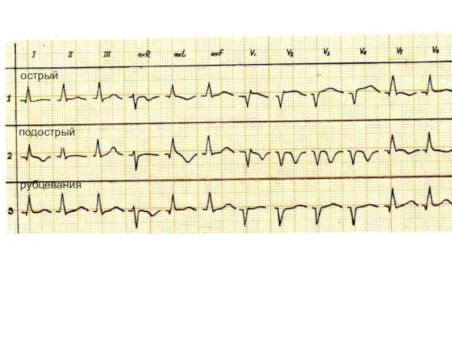 острый подострый рубцевания