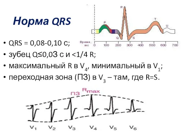 Норма QRS QRS = 0,08-0,10 с; зубец Q≤0,0З с и