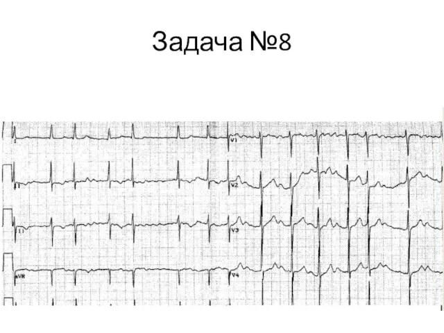 Задача №8