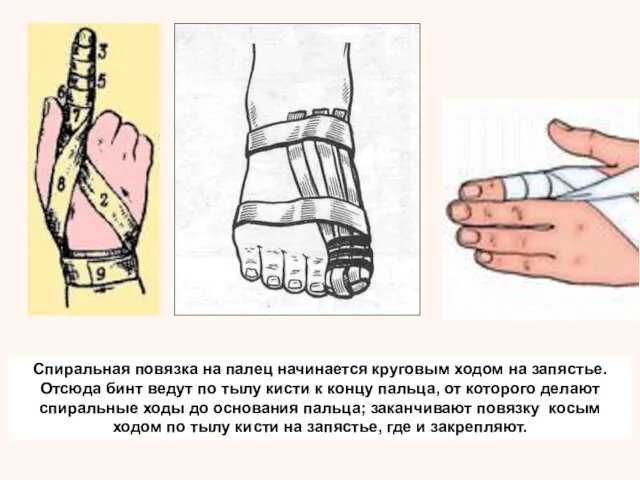 Спиральная повязка на палец начинается круговым ходом на запястье. Отсюда