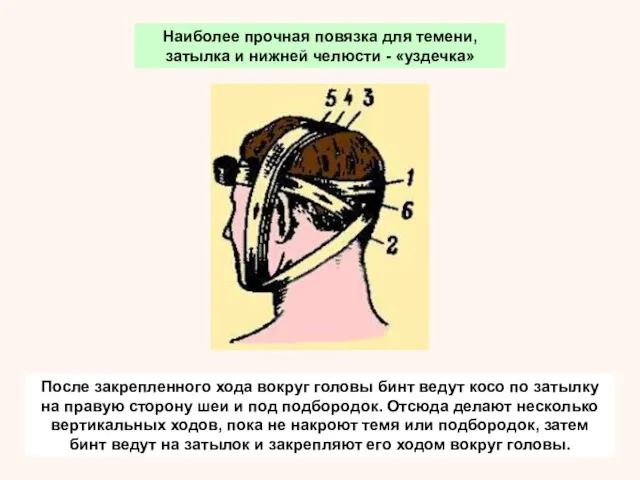 После закрепленного хода вокруг головы бинт ведут косо по затылку