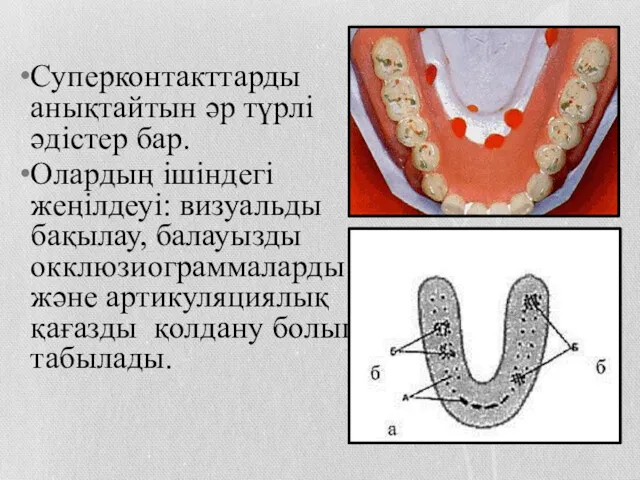 Суперконтакттарды анықтайтын әр түрлі әдістер бар. Олардың ішіндегі жеңілдеуі: визуальды