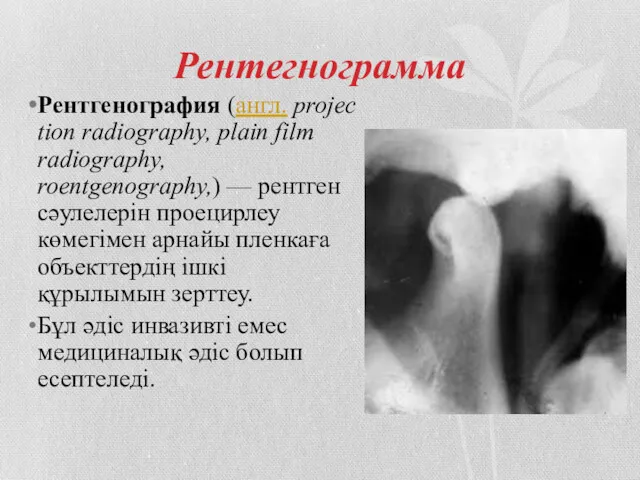 Рентегнограмма Рентгенография (англ. projection radiography, plain film radiography, roentgenography,) —