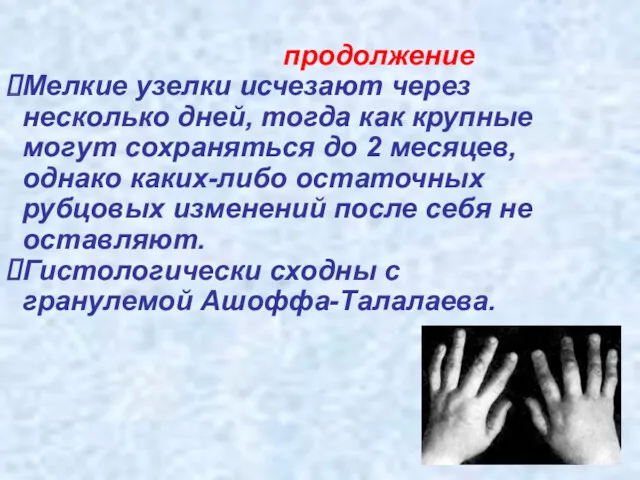 продолжение Мелкие узелки исчезают через несколько дней, тогда как крупные