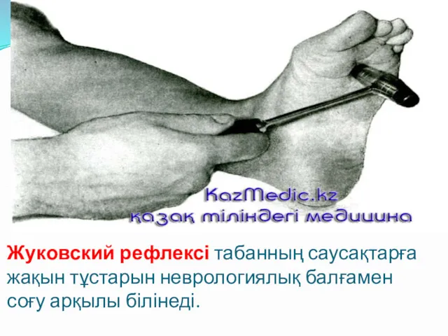 Жуковский рефлексі табанның саусақтарға жақын тұстарын неврологиялық балғамен соғу арқылы білінеді.