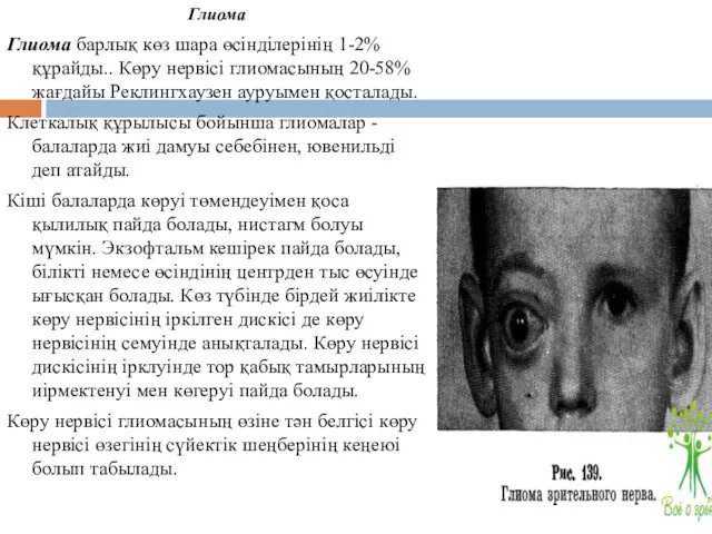 Глиома Глиома барлық көз шара өсінділерінің 1-2% құрайды.. Көру нервісі