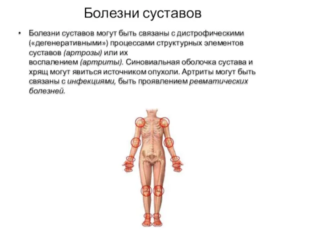 Болезни суставов Болезни суставов могут быть связаны с дистрофическими («дегенеративными»)