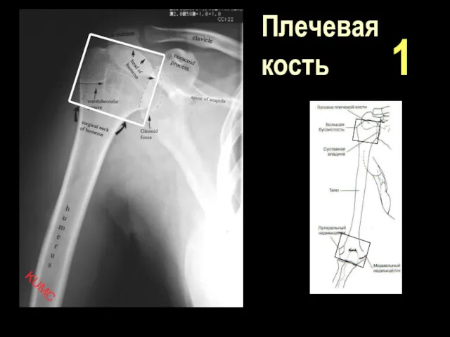 Плечевая кость 1