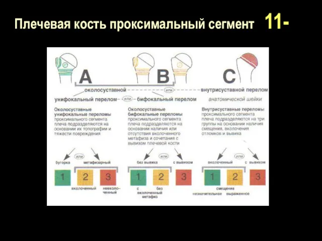 Плечевая кость проксимальный сегмент 11-