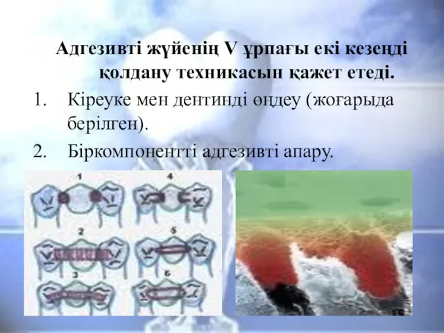 Адгезивті жүйенің V ұрпағы екі кезеңді қолдану техникасын қажет етеді.