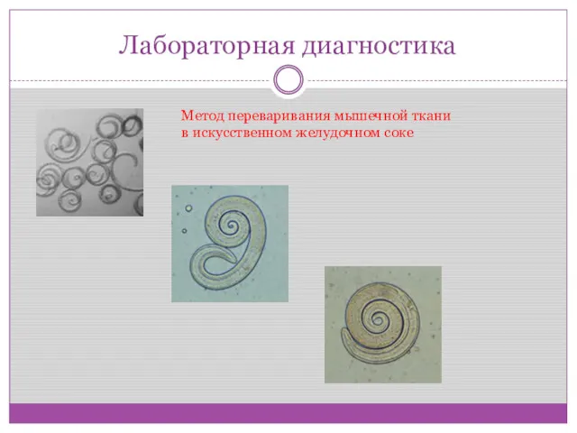 Лабораторная диагностика Метод переваривания мышечной ткани в искусственном желудочном соке