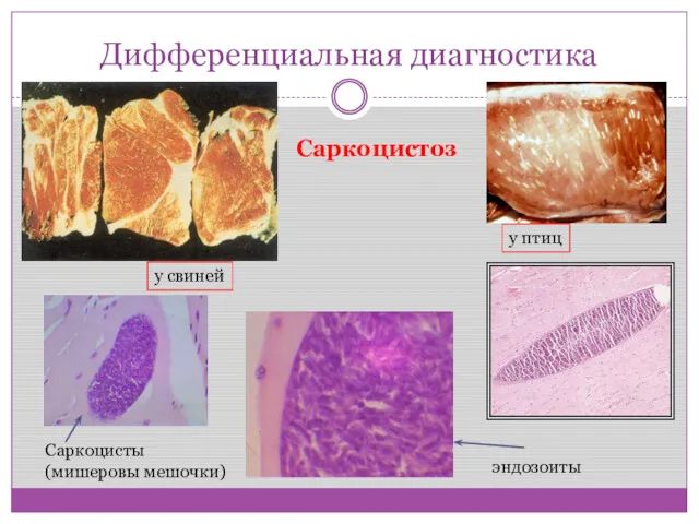 Дифференциальная диагностика Саркоцистоз Саркоцисты (мишеровы мешочки) эндозоиты у свиней у птиц